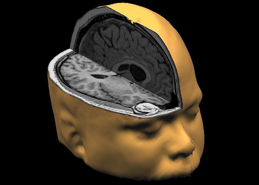 brain  tomography